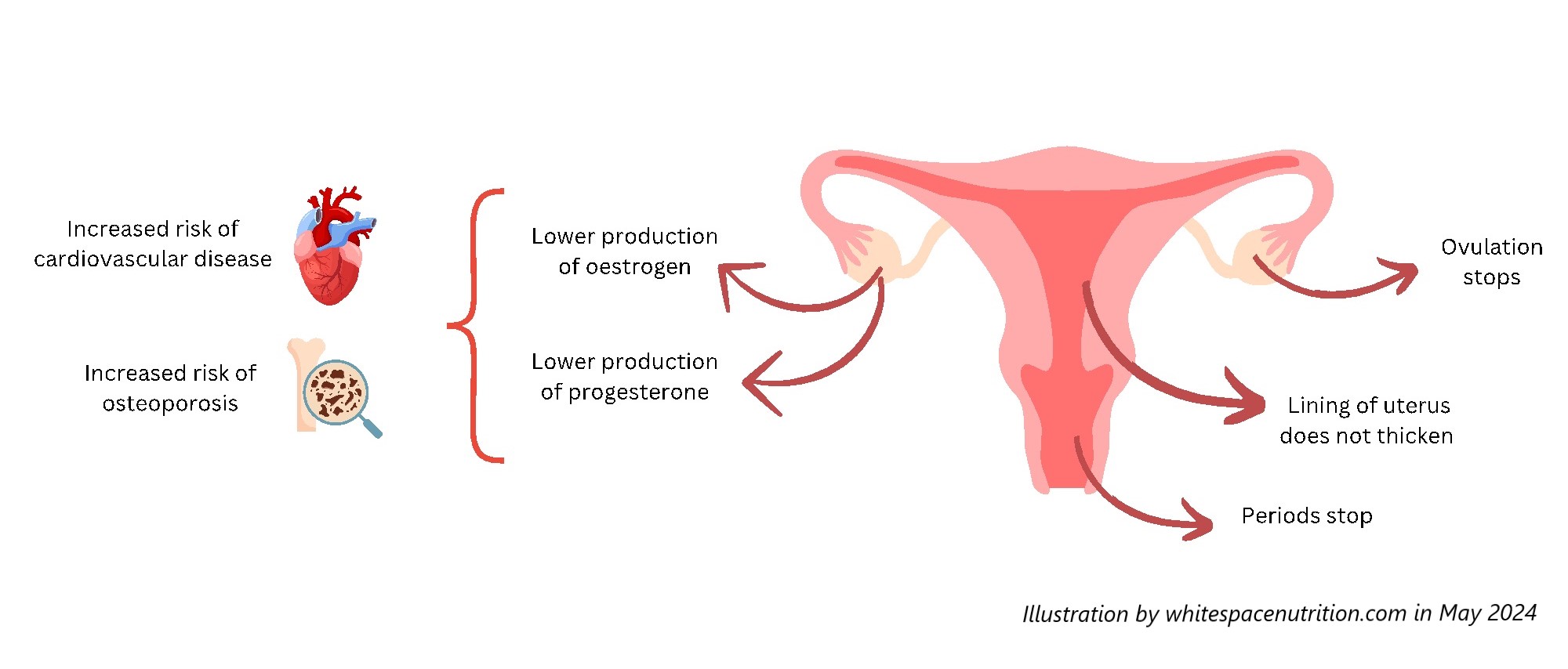Menopause health implications